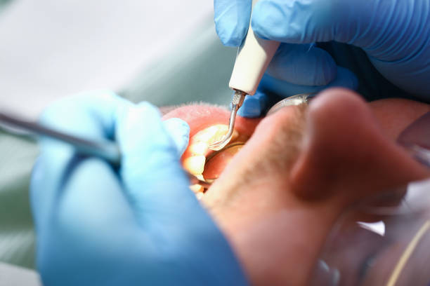 Best Pediatric Emergency Dentist in Atlanta, IL