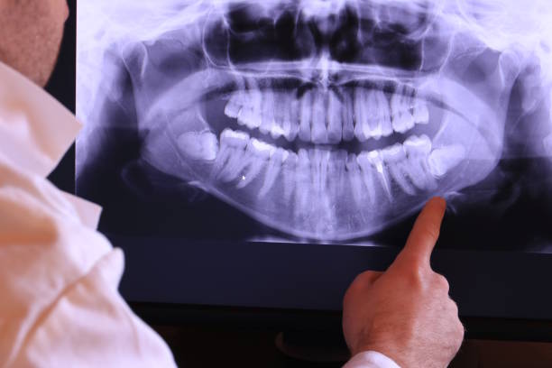 Best Pediatric Emergency Dentist in Atlanta, IL