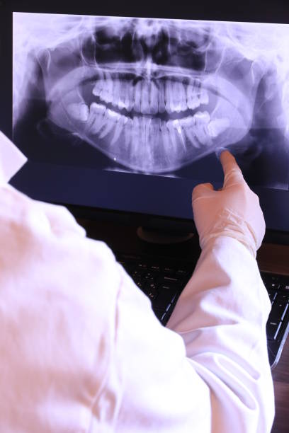 Best Emergency Dental Care for Abscessed Tooth in Atlanta, IL