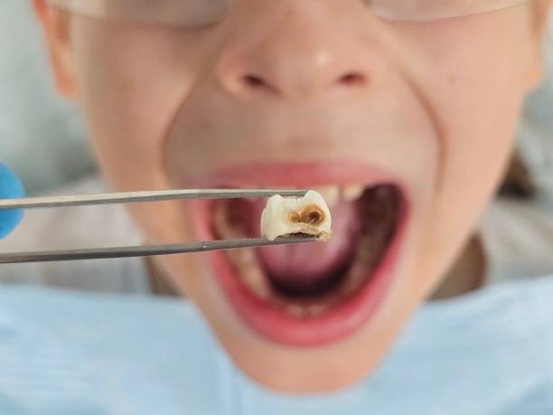 Best Emergency Cosmetic Dentistry in Atlanta, IL