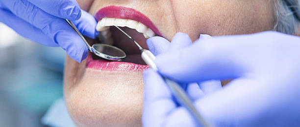 Best Emergency Root Canal Treatment in Atlanta, IL